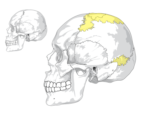 Ossa suturali del cranio